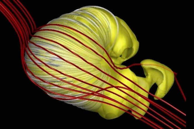 The true shape of the heliosphere: forget what you were taught in school