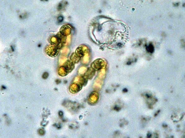 Cyanobacteria.