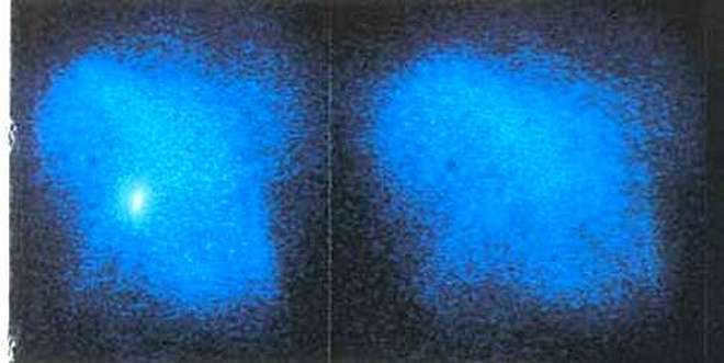 Pulsar in the Crab Nebula